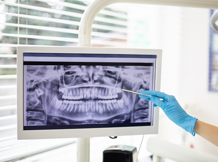 Digital X-Rays Benefits Image