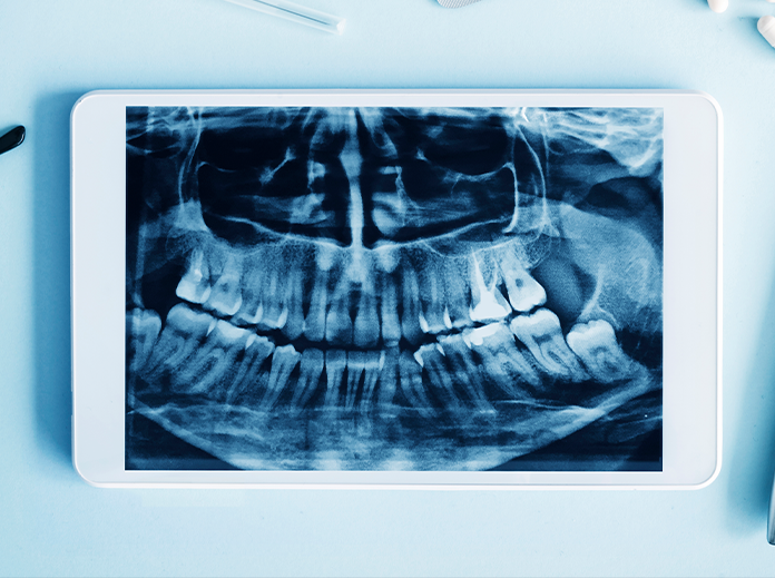 Digital X-Rays Image