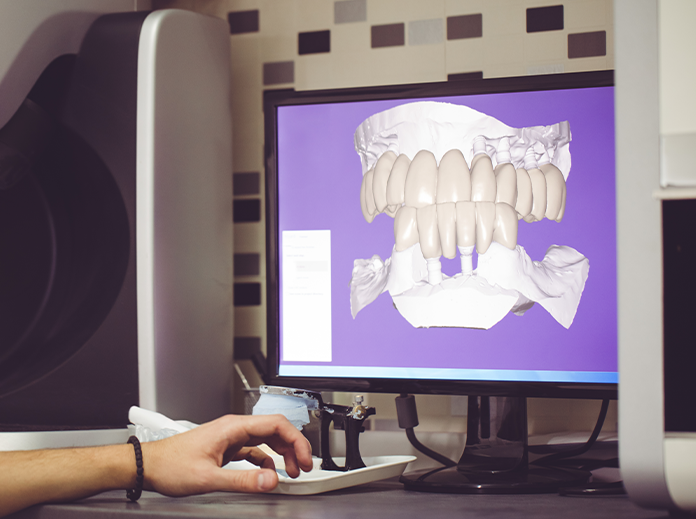 Intra-oral camera Benefits Imag