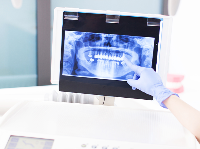 Intra-oral scanner Benefits Image